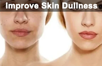 Improve skin dullness Improve skin dullness
